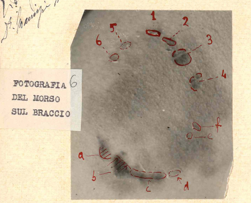 Rilievi dei medici legali sulla fotografia del morso sul braccio di Vittoria Nicolotti