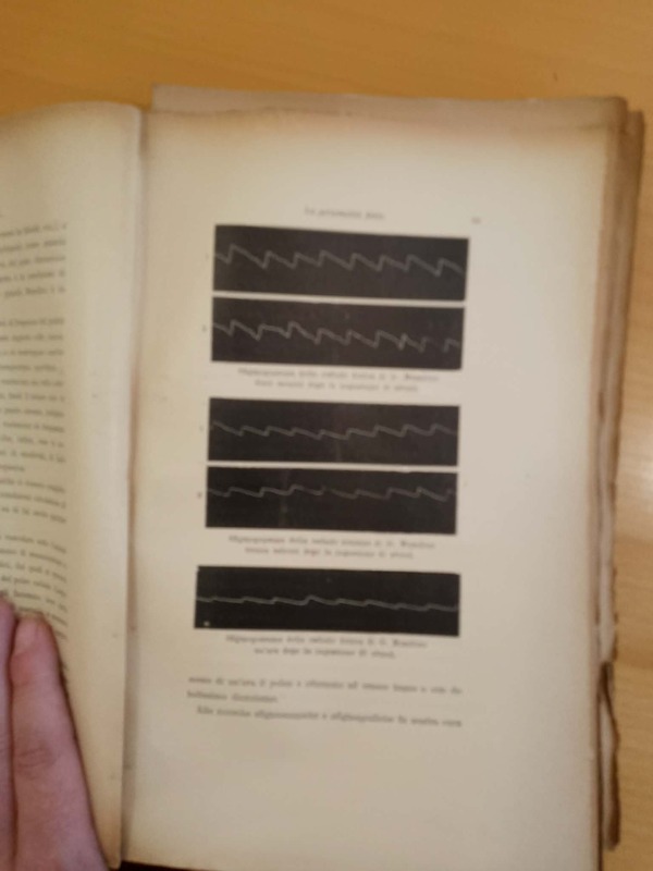 Diagrammi che registrano varie forme di sensibilità di Musolino