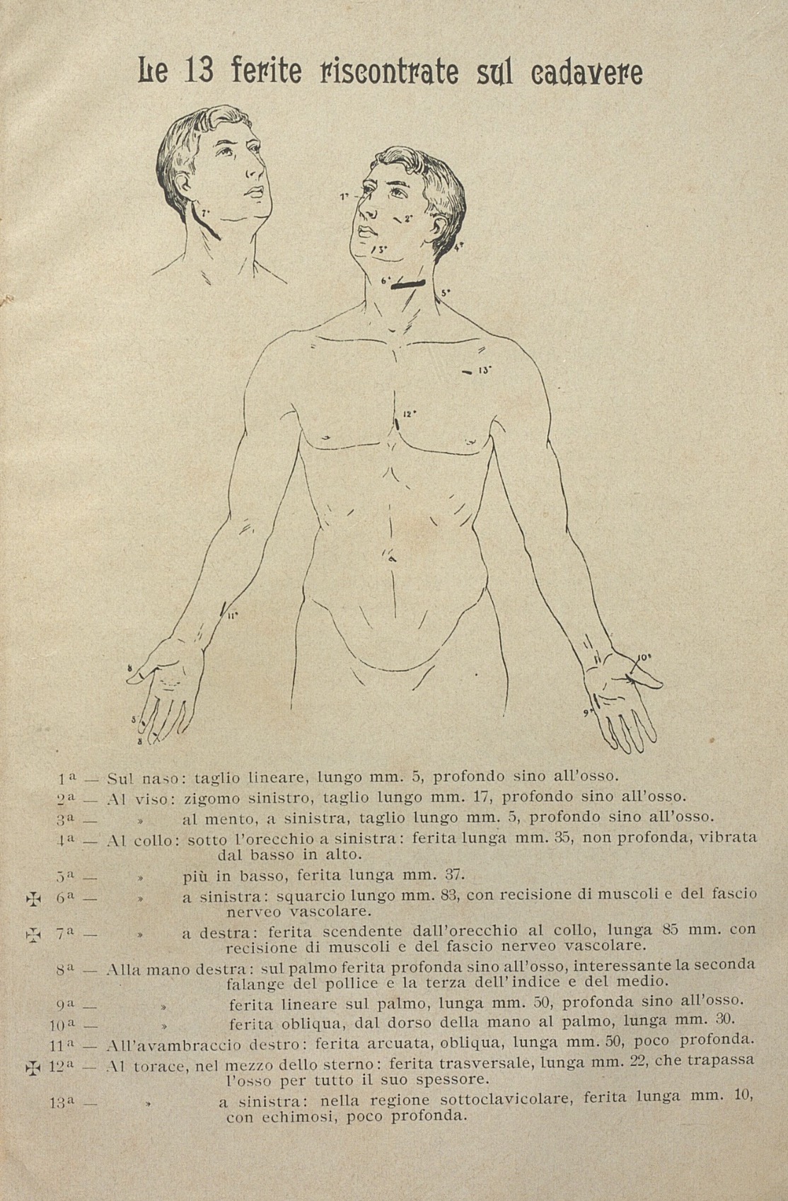 "Le 13 ferite riscontrate sul cadavere"