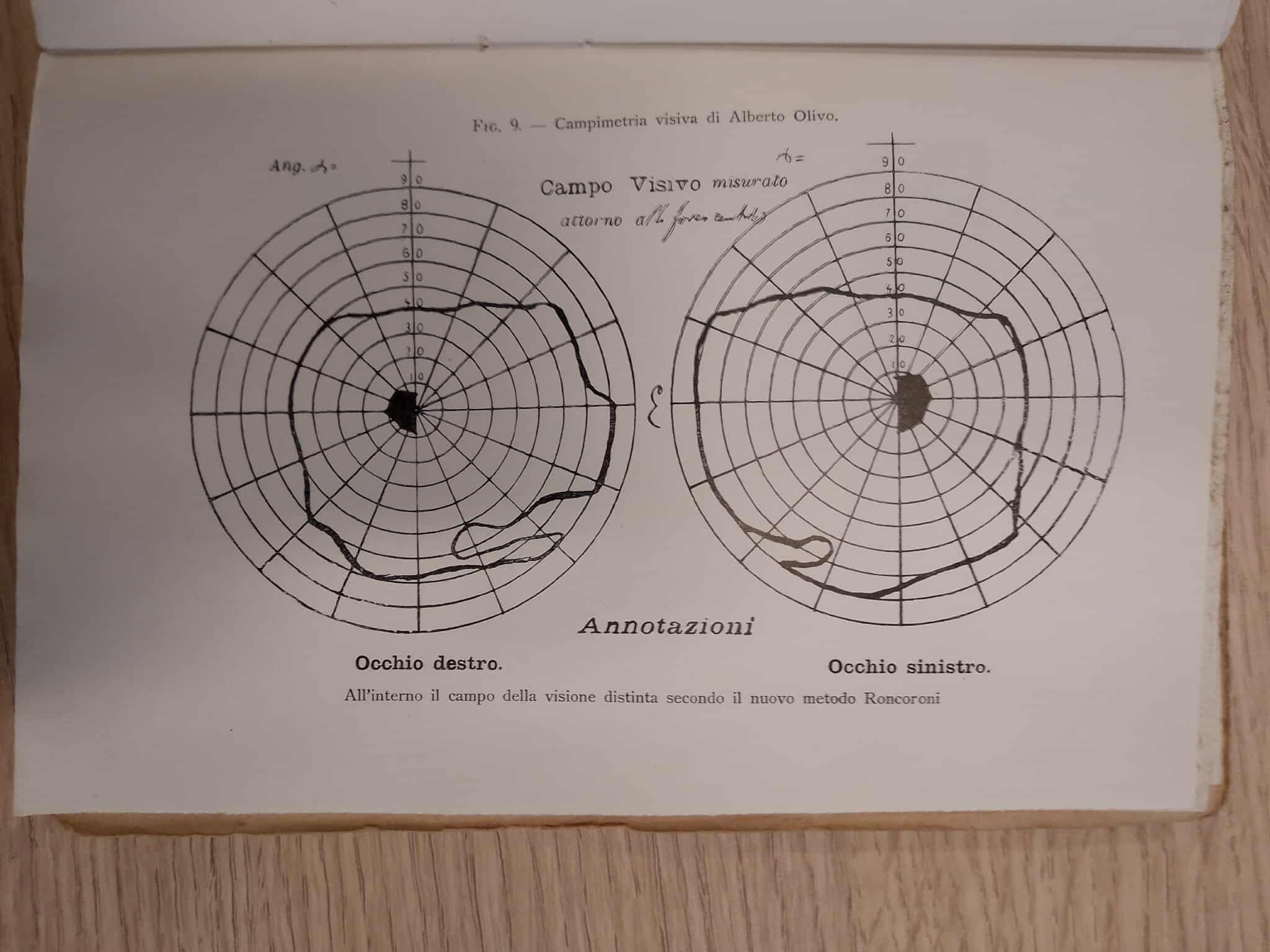 Diagrammi del campo visivo di Alberto Olivo