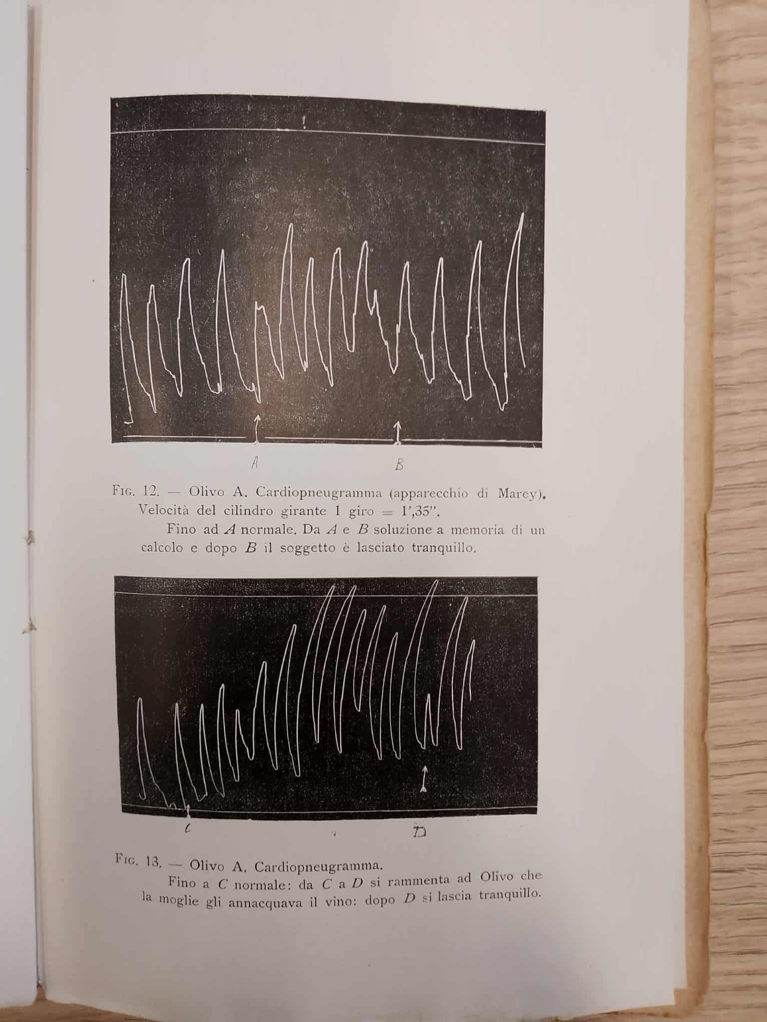 Diagrammi risultanti da esperimenti atti a misurare la sensibilità dell'uxoricida Alberto Olivo