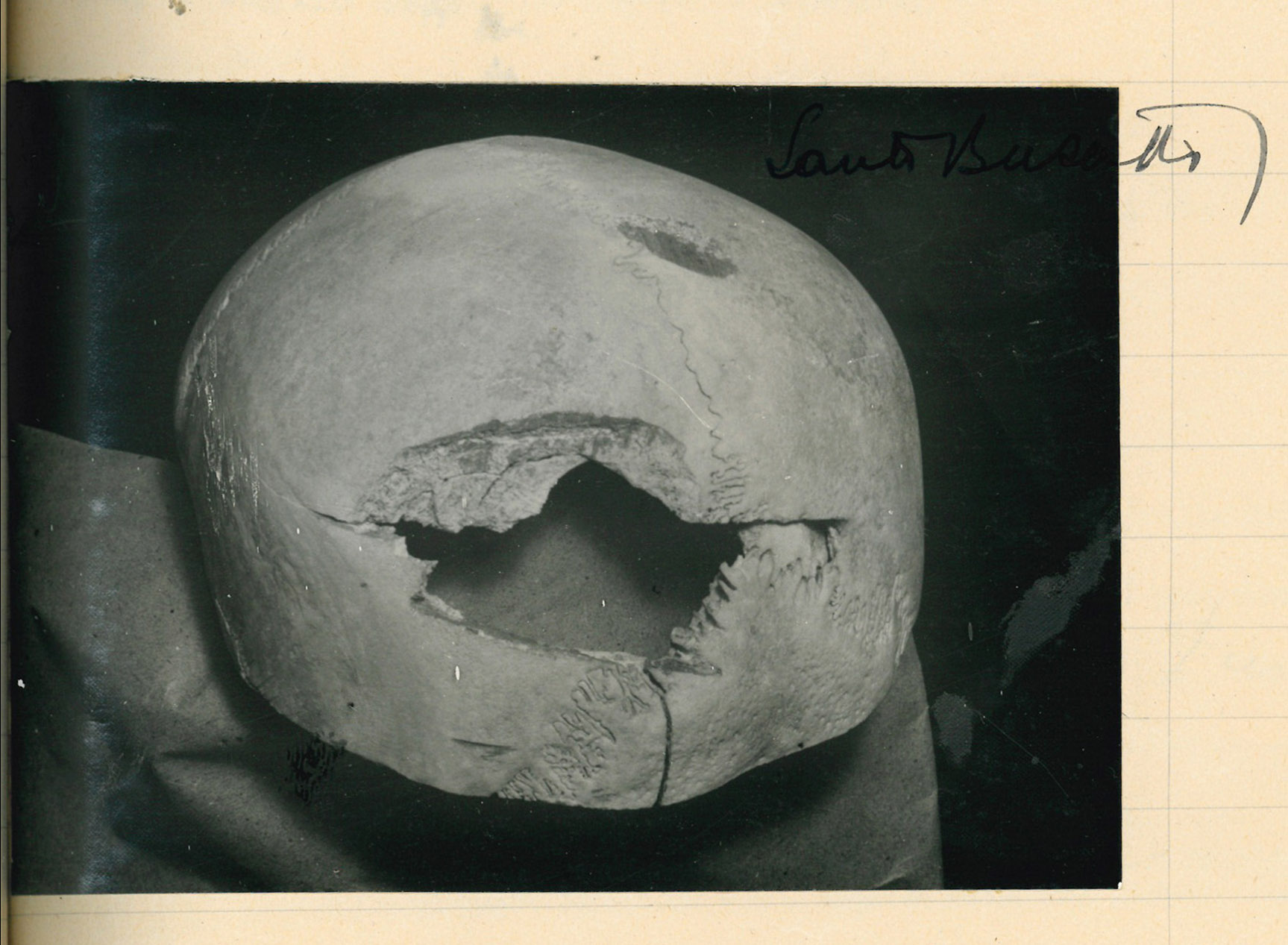 La calotta cranica di Palmira Perruchon