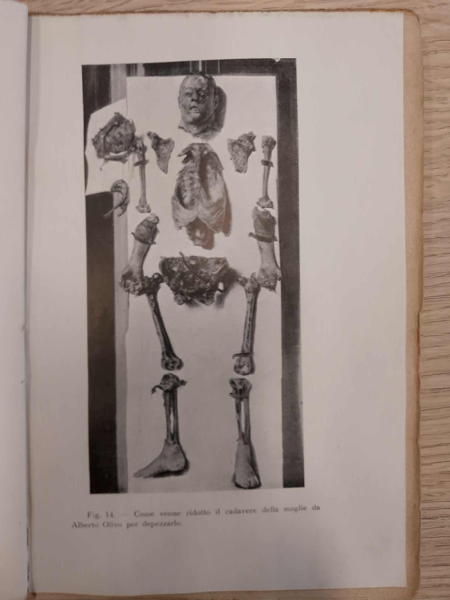 I reperti cadaverici di Ernestina Beccaro, moglie di Alberto Olivo