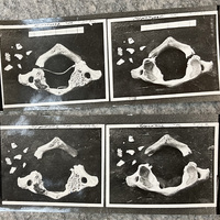 Foto dell'atlante di Vincenzina Virando