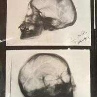 Riproduzione della radiografia del capo di Vincenzina Virando